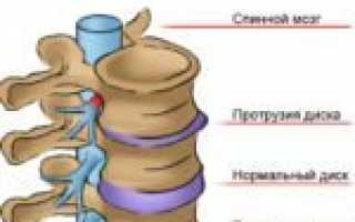 Драстоп уколы: состав и эффективность препарата