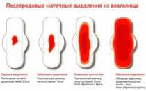 Особенности маточного кровотечения