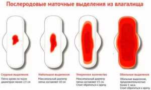 Особенности маточного кровотечения